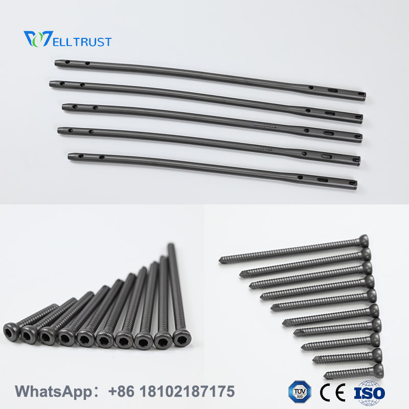 intramedullary interlocking nail