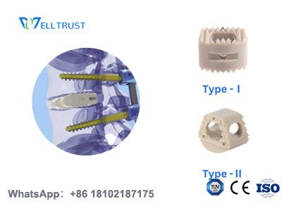 What Is a PEEK Cage? Is PEEK Better Than Titanium? | Well Trust