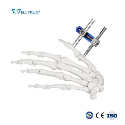 mini external fixator